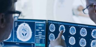 No todo bulto es cáncer: cómo diferenciar un nódulo, un quiste y un tumor No todo bulto es cáncer: cómo diferenciar un nódulo, un quiste y un tumor