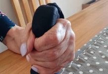 Reportaje | Innovación USM busca aliviar el dolor y mejorar la movilidad de personas con artrosis en el pulgar