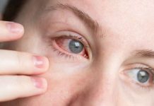 ¿Ojo rojo?: Cómo distinguir una alergia de una infección y cuándo consultar a un especialista
