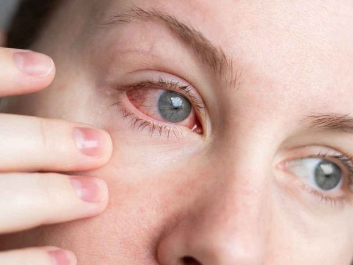 ¿Ojo rojo?: Cómo distinguir una alergia de una infección y cuándo consultar a un especialista